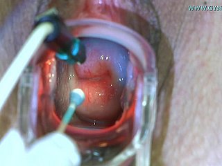 スキニーハーロは彼女のGyno Doctorに来て、完全な試験に合格する必要があります