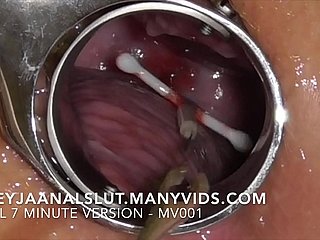 الهواة Freyjaanalslut: إزالة IUD لها - سحبها من عنق الرحم Freyja، مما يجعلها خصبة مرة أخرى - النسخة الكاملة على Manyvids