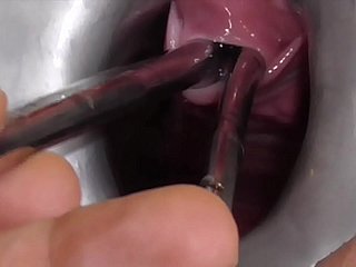 الهواة Freyjaanalslut: أصوات متعددة - جيمس تمتد مجرى البول مع أصوات متعددة - التبول في مهبل الفجوة في Freyja