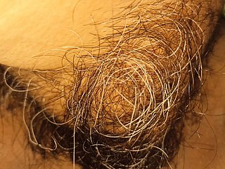 Vợ tôi có lông âm hộ và âm vật