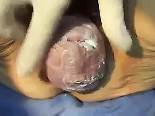 Bà của âm hộ