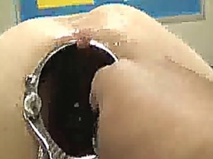 令人震惊的肛门窥器张开和拳交