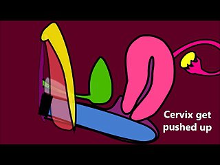 Bagaimana An obstacle Vagina Pekerjaan